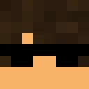 Kosoglooos classic skin texture