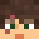SoerTn0s classic skin texture