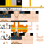 1Fortuna classic skin texture